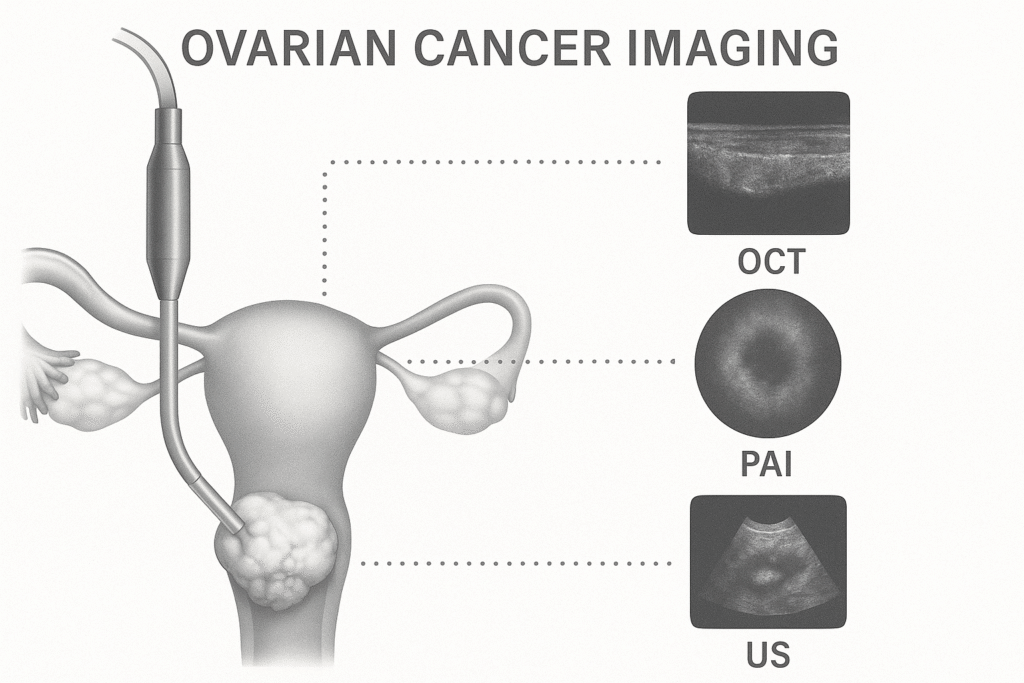 Ovarian Cancer Imaging
